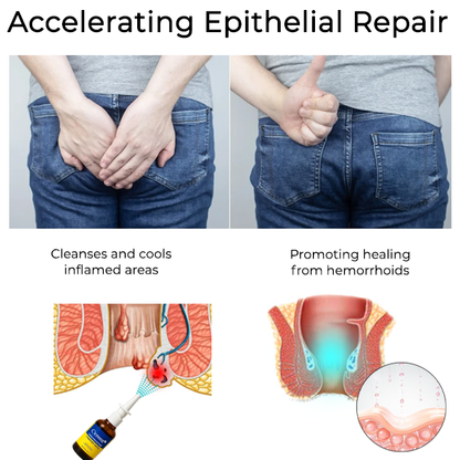 Herbal Hemorrhoid Treatment Anal Spray Pro